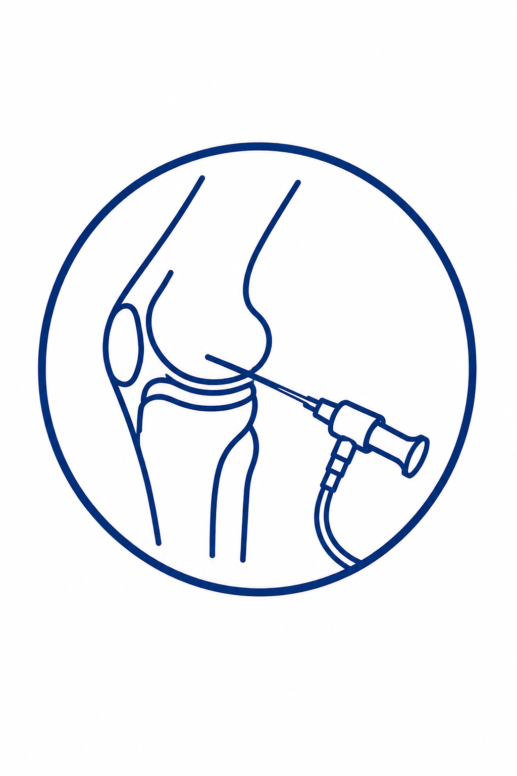 Artroscopia de Rodilla