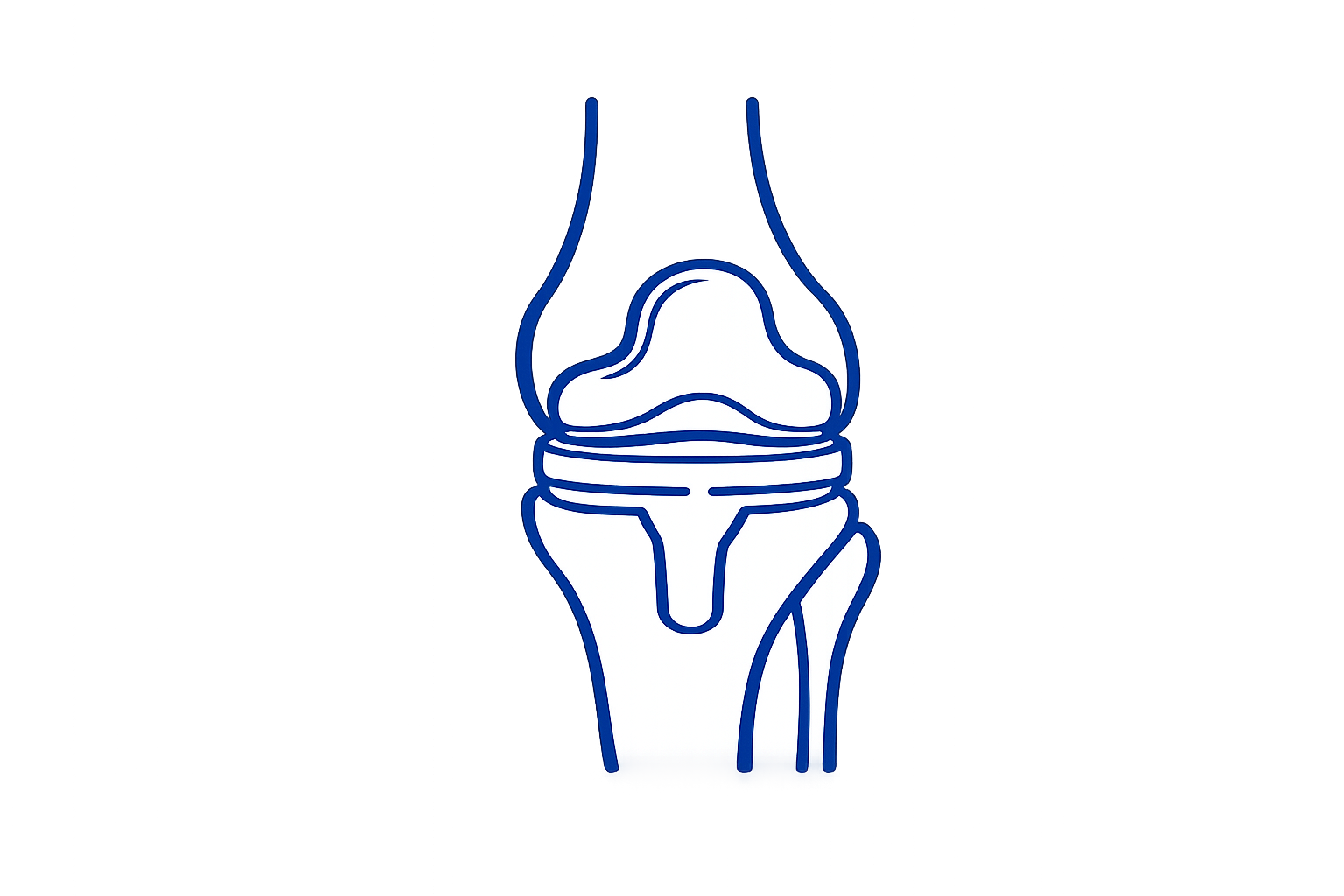 Prótesis de rodilla